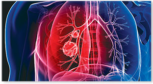 lung-cancer-thumbnail